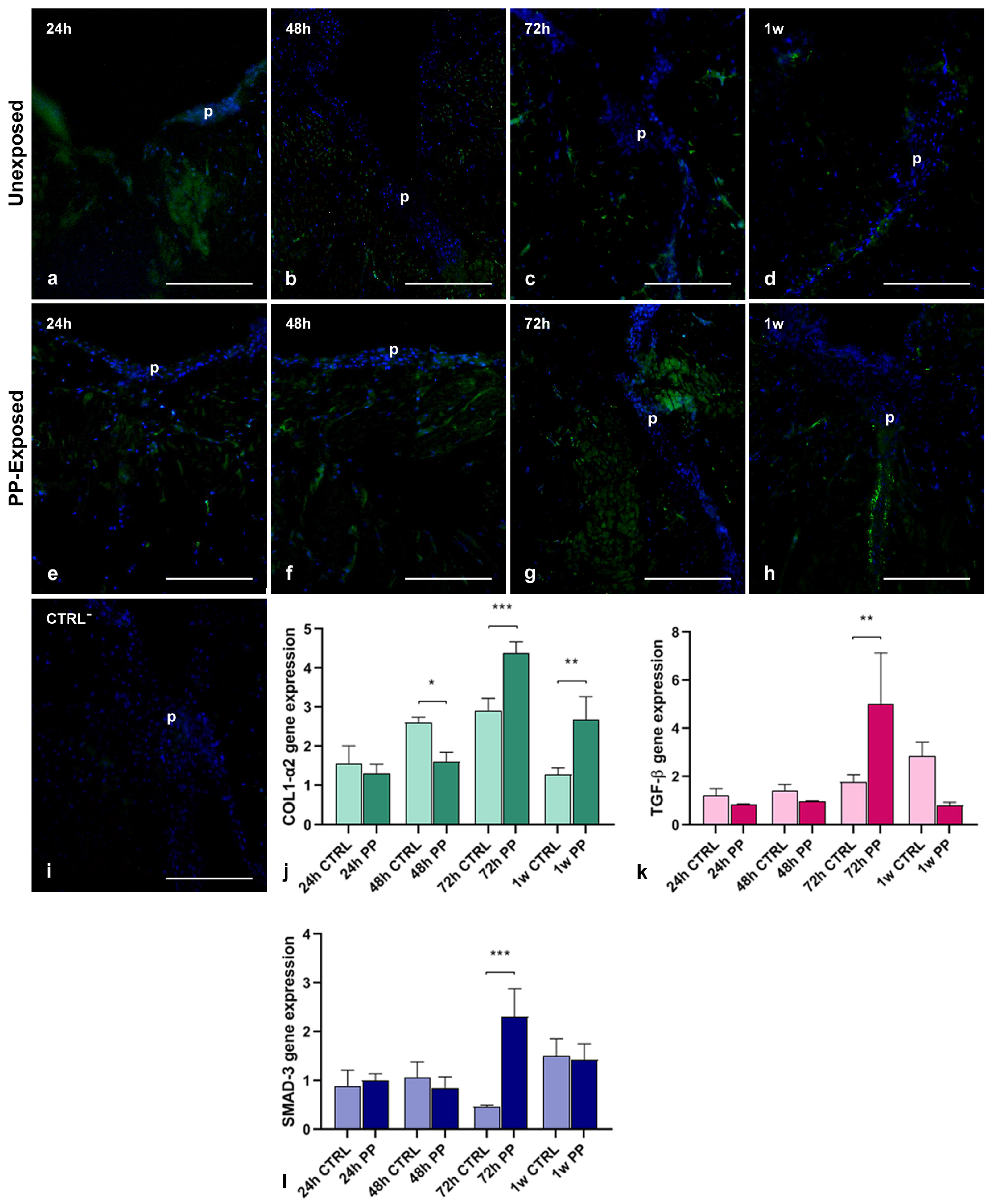 Microplastics 04 00056 g005 Microplastics 04 00056 g005