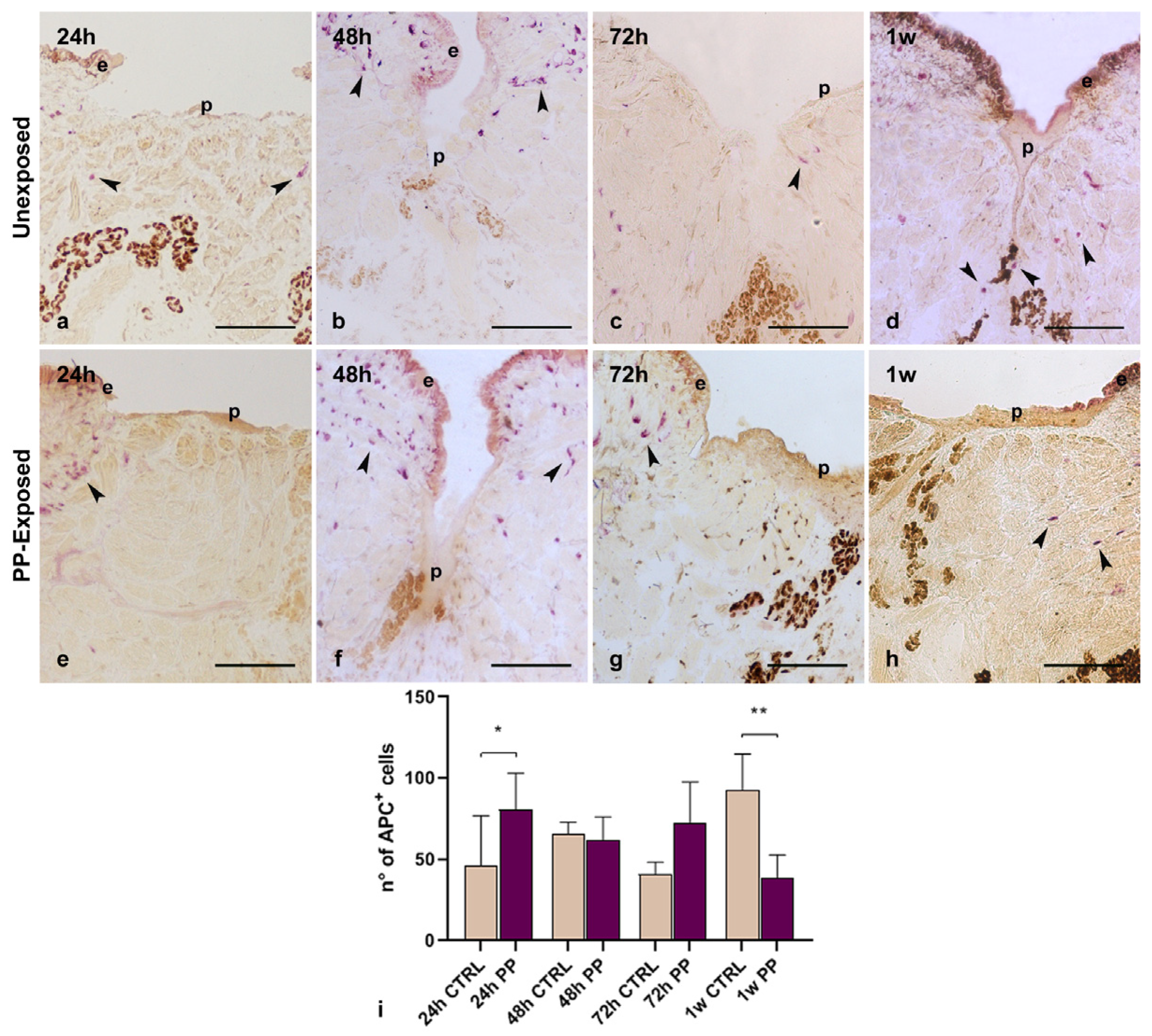 Microplastics 04 00056 g007 Microplastics 04 00056 g007