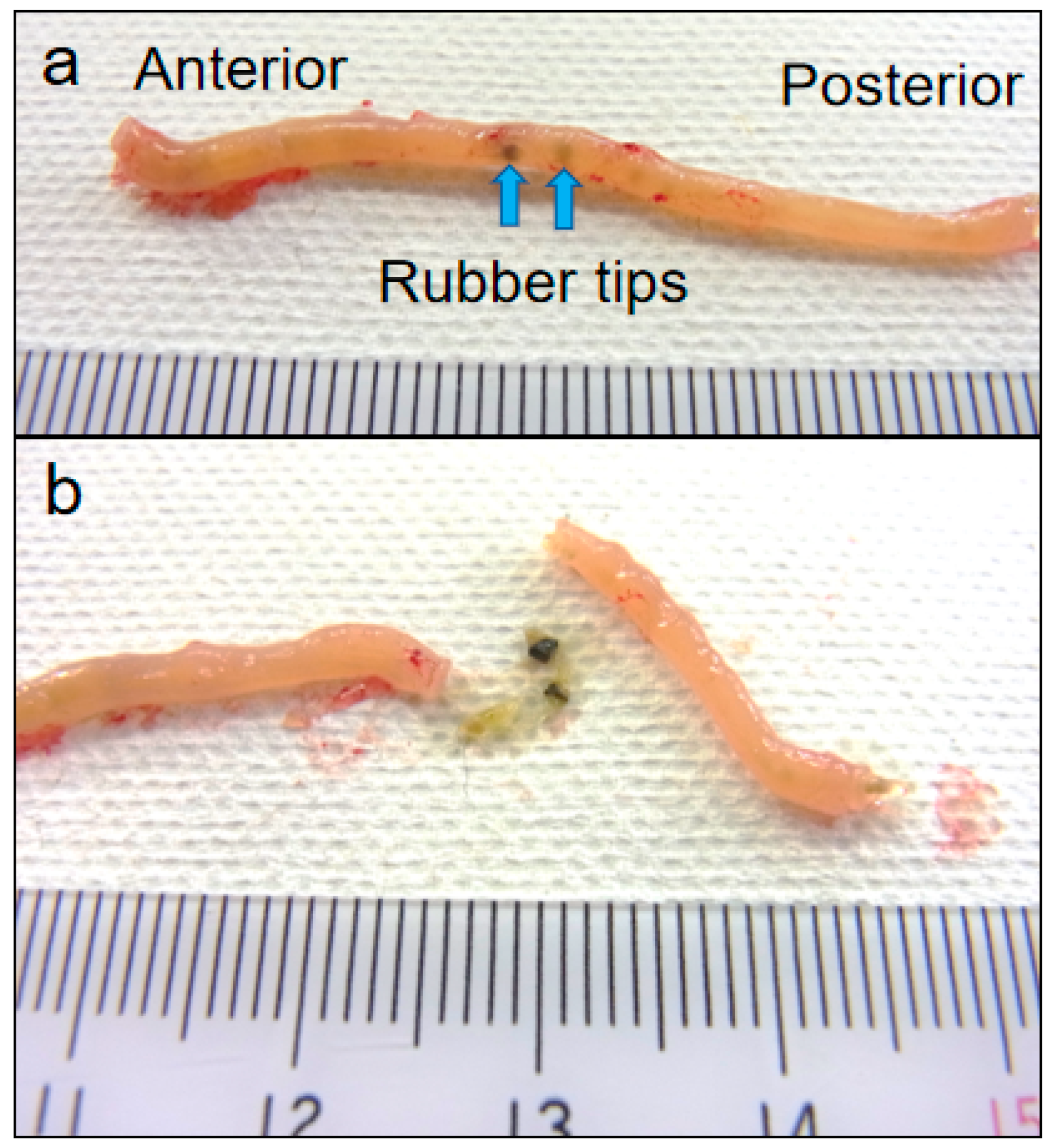 Microplastics 04 00092 g011 Microplastics 04 00092 g011