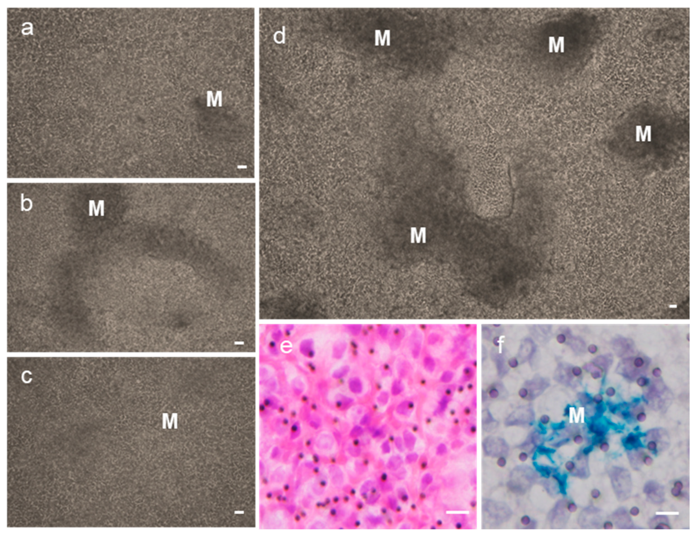 Microplastics 05 00031 g003