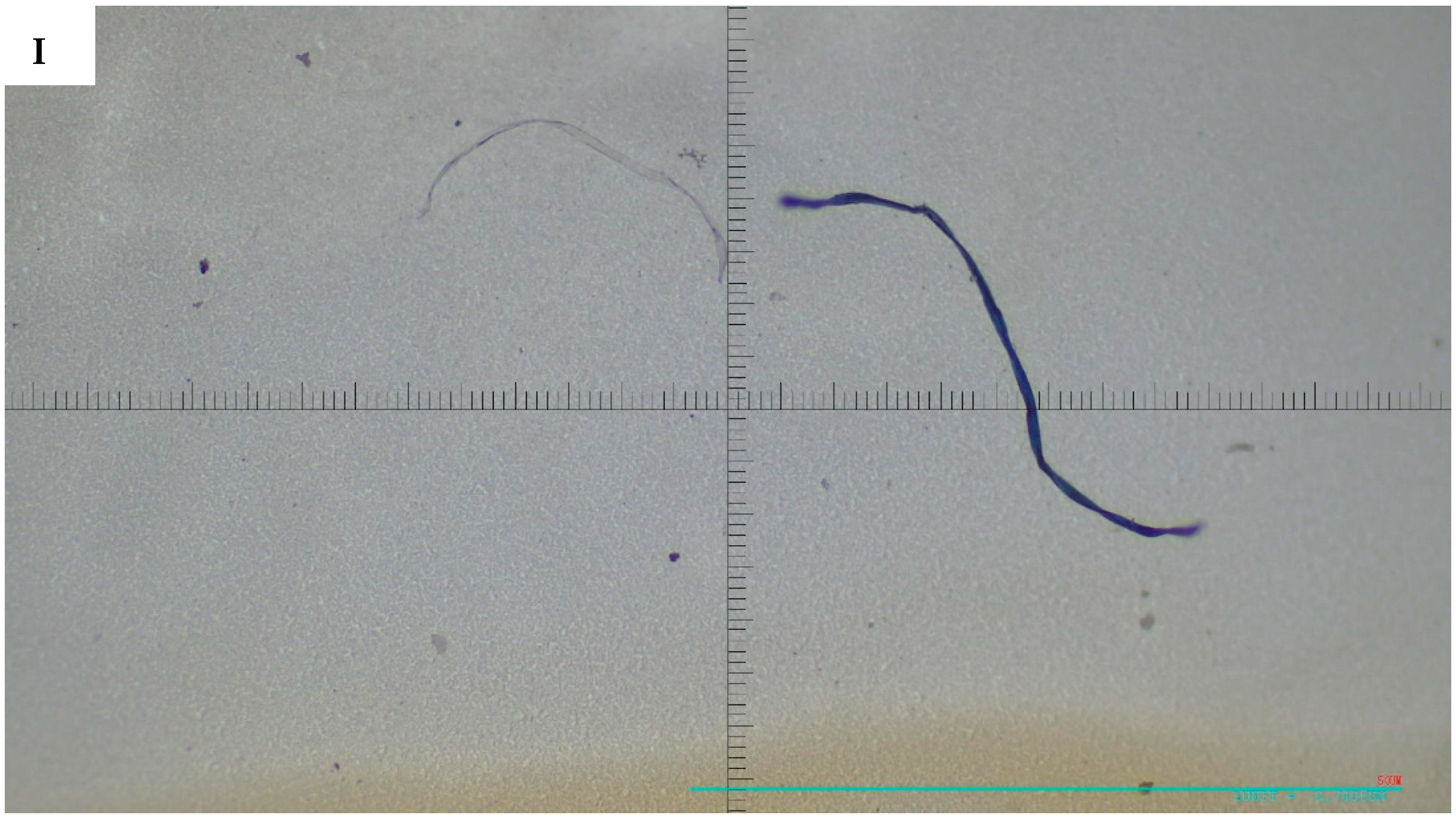 Microplastics 05 00125 g004d