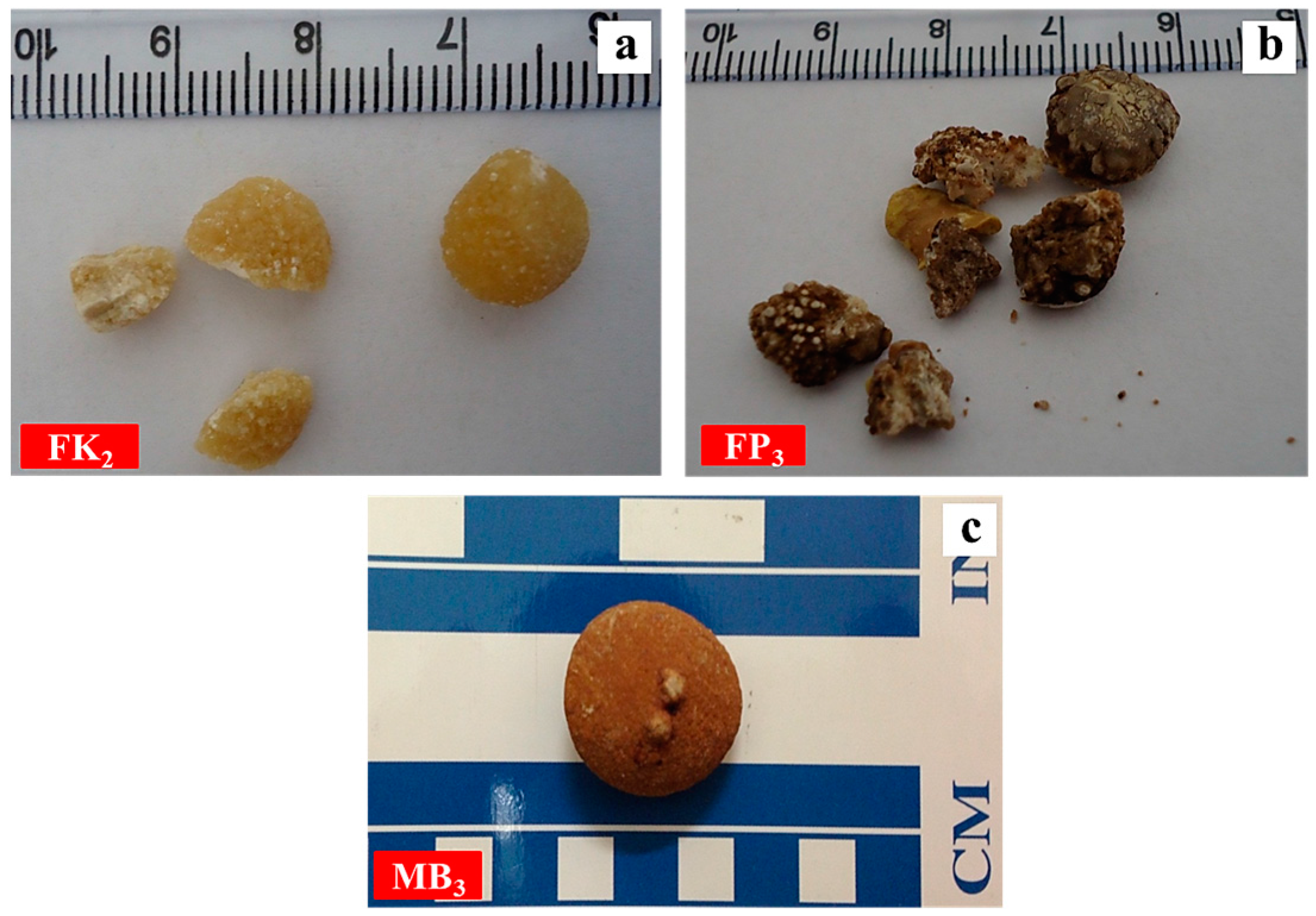 minerals free full text mineralogical composition of urinary urinary stones