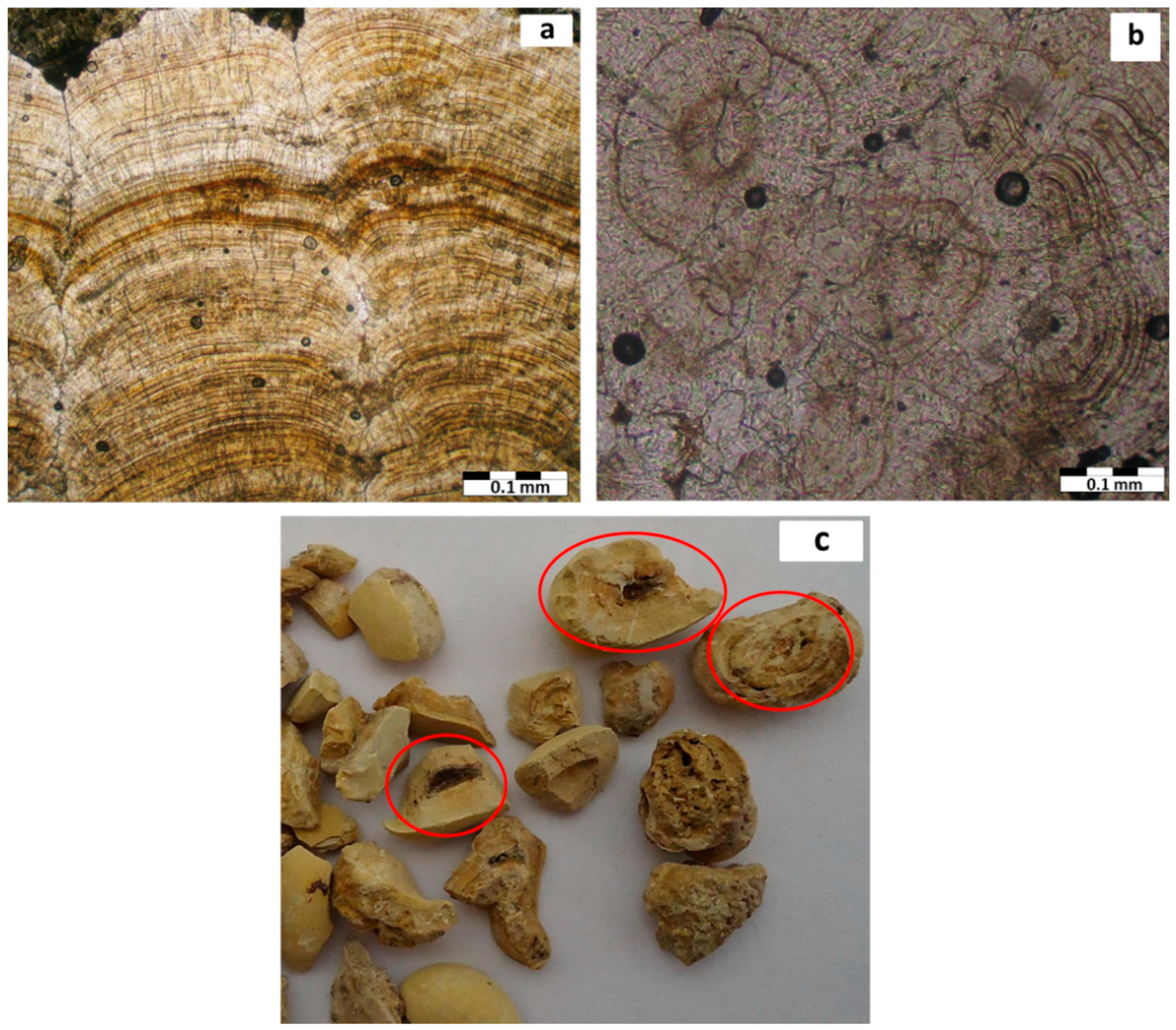 minerals free full text mineralogical composition of urinary urinary stones