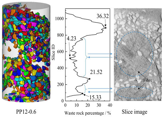 ははは56 Identified IGSF9 association with prognosis and hypoxia in