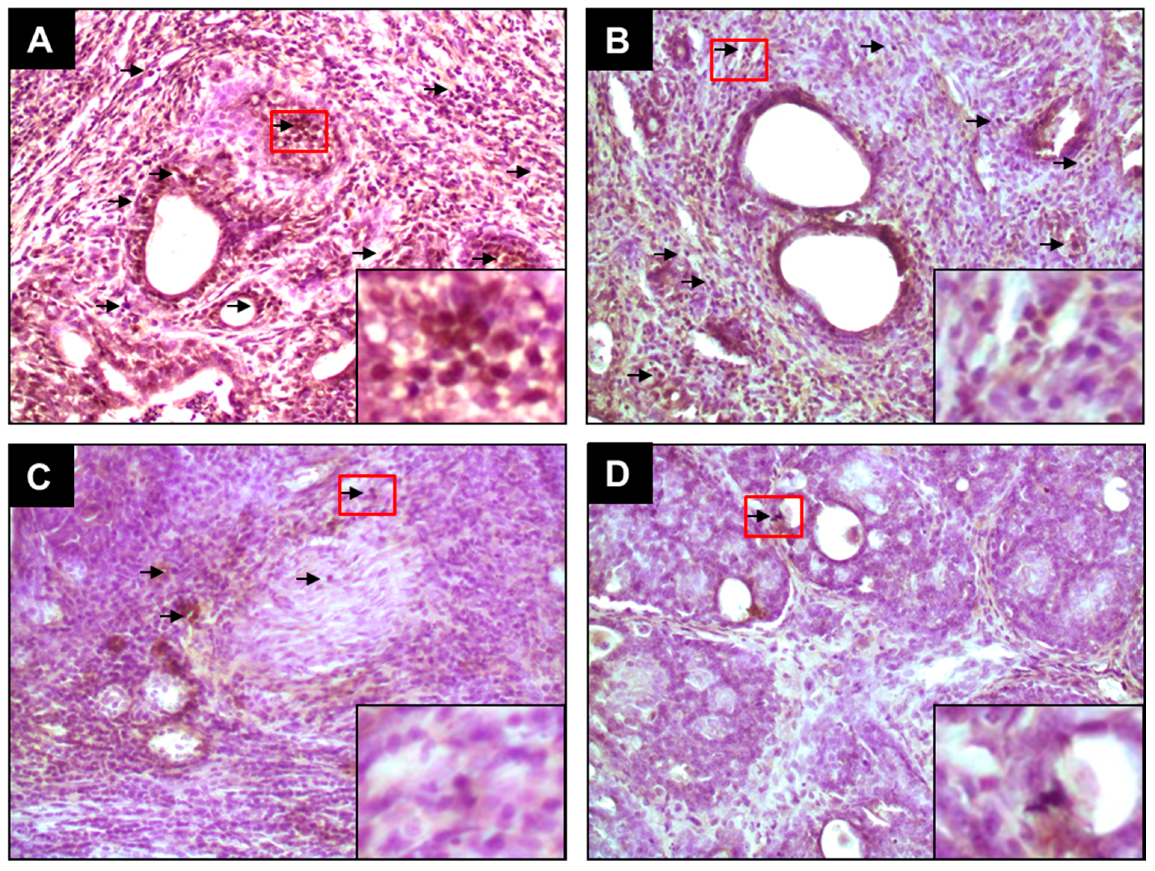 Mechanism of Breast Cancer Preventive Action of Pomegranate