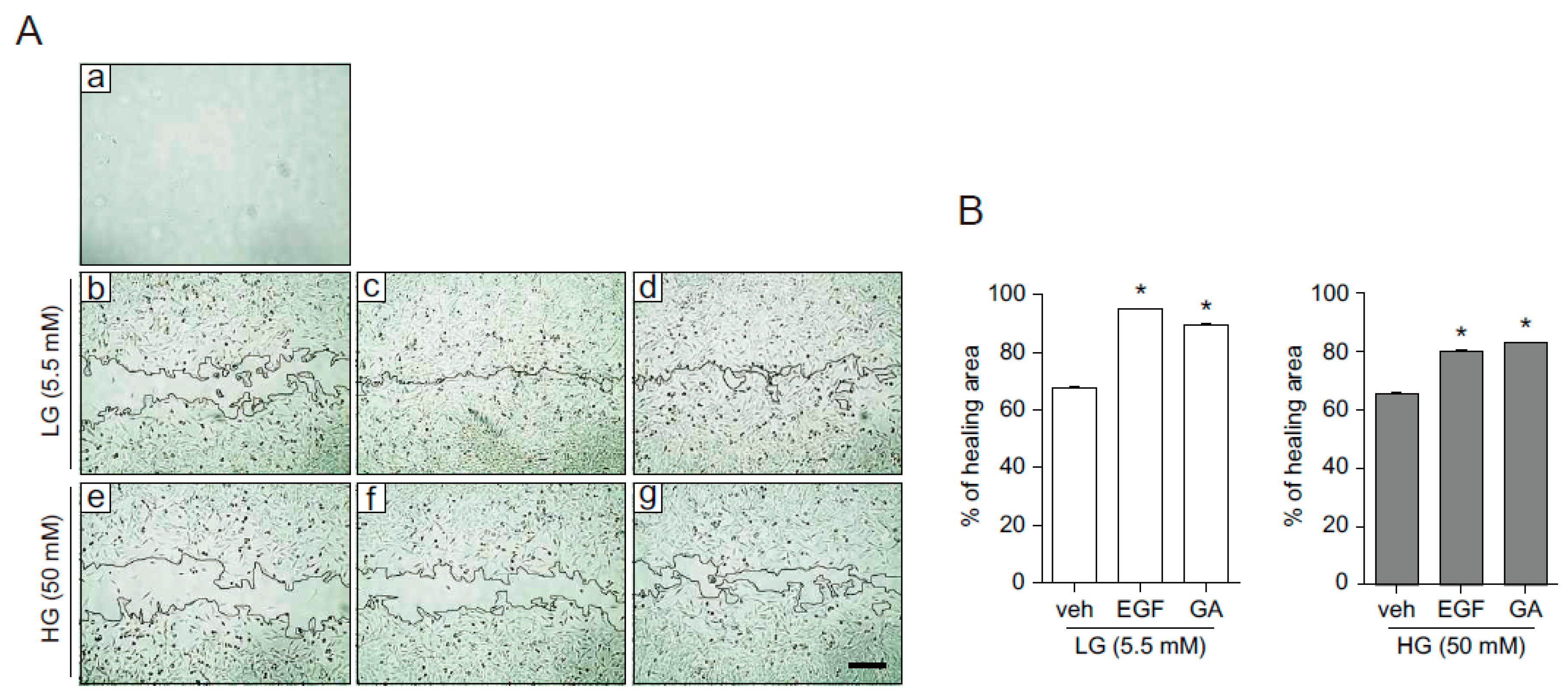 Molecules Free Full Text Gallic Acid Promotes Wound Healing In Normal And Hyperglucidic Conditions Html