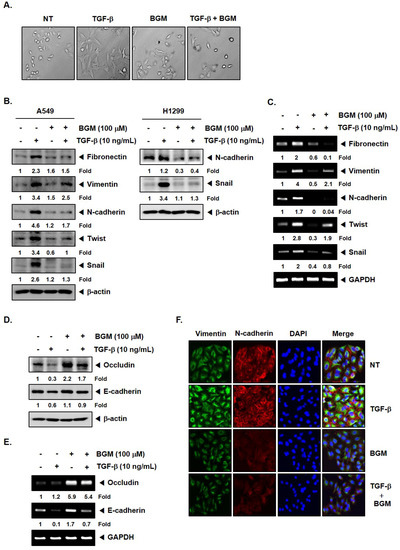 Molecules Free Full Text Bergamottin Suppresses Metastasis Of Lung Cancer Cells Through Abrogation Of Diverse Oncogenic Signaling Cascades And Epithelial To Mesenchymal Transition Html