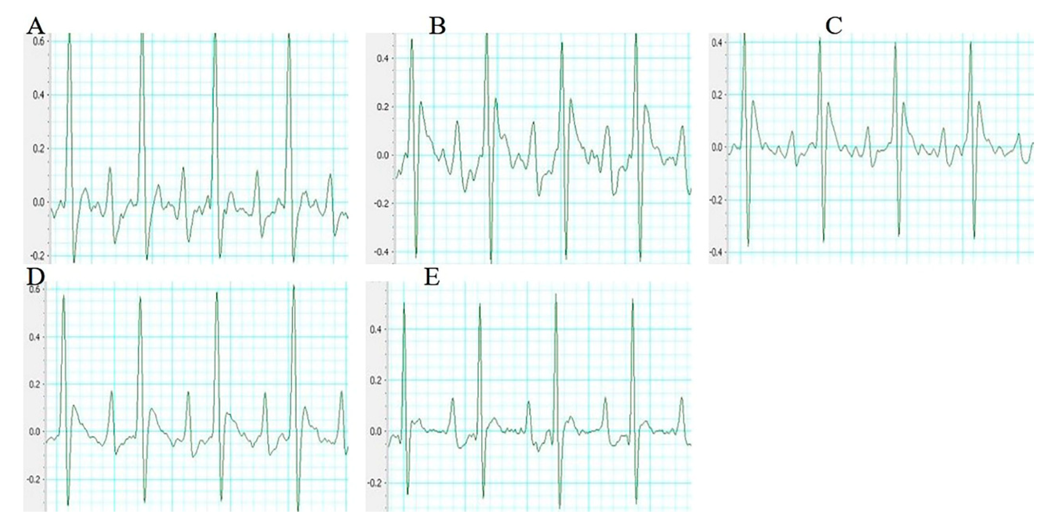 Molecules 24 04416 g002 Molecules 24 04416 g002