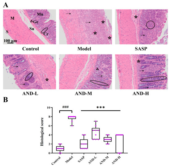 Improvement of Oxazolone-Induced Ulcerative Colitis in Rats