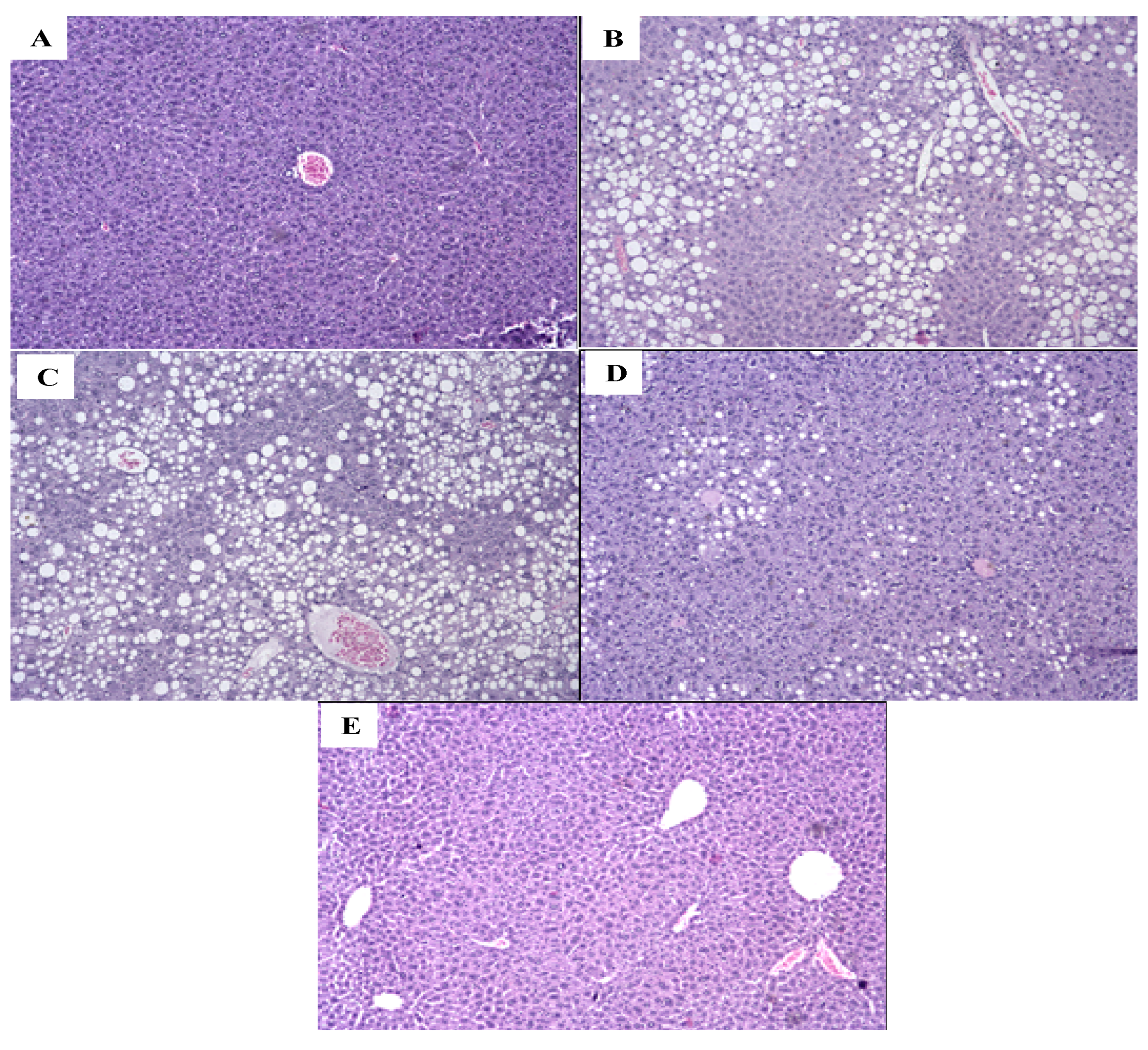 Molecules 25 02693 g005