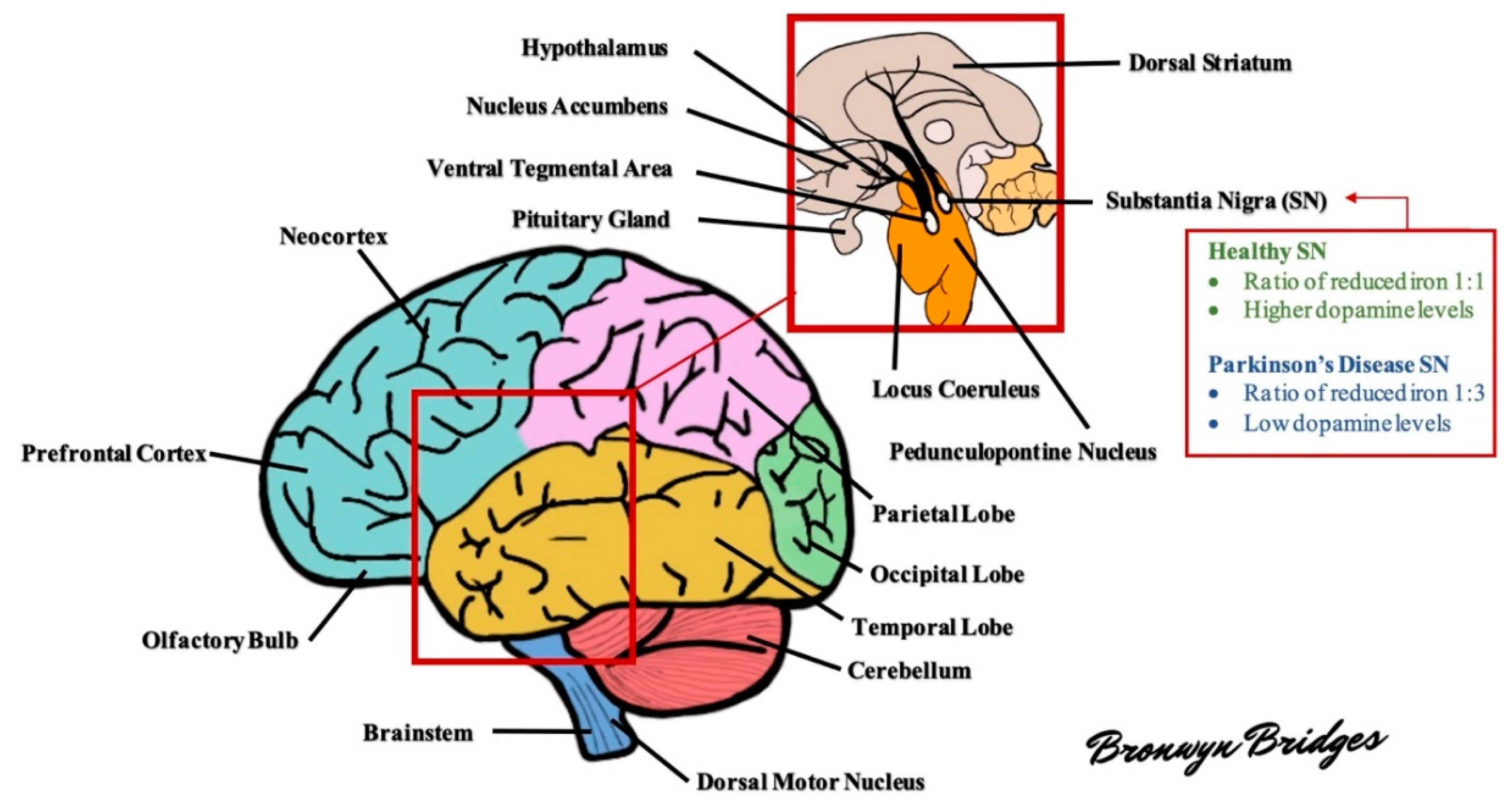 Molecules | Free Full-Text | The Pathology of Parkinson's Disease and Potential Benefit of Dietary Polyphenols | HTML