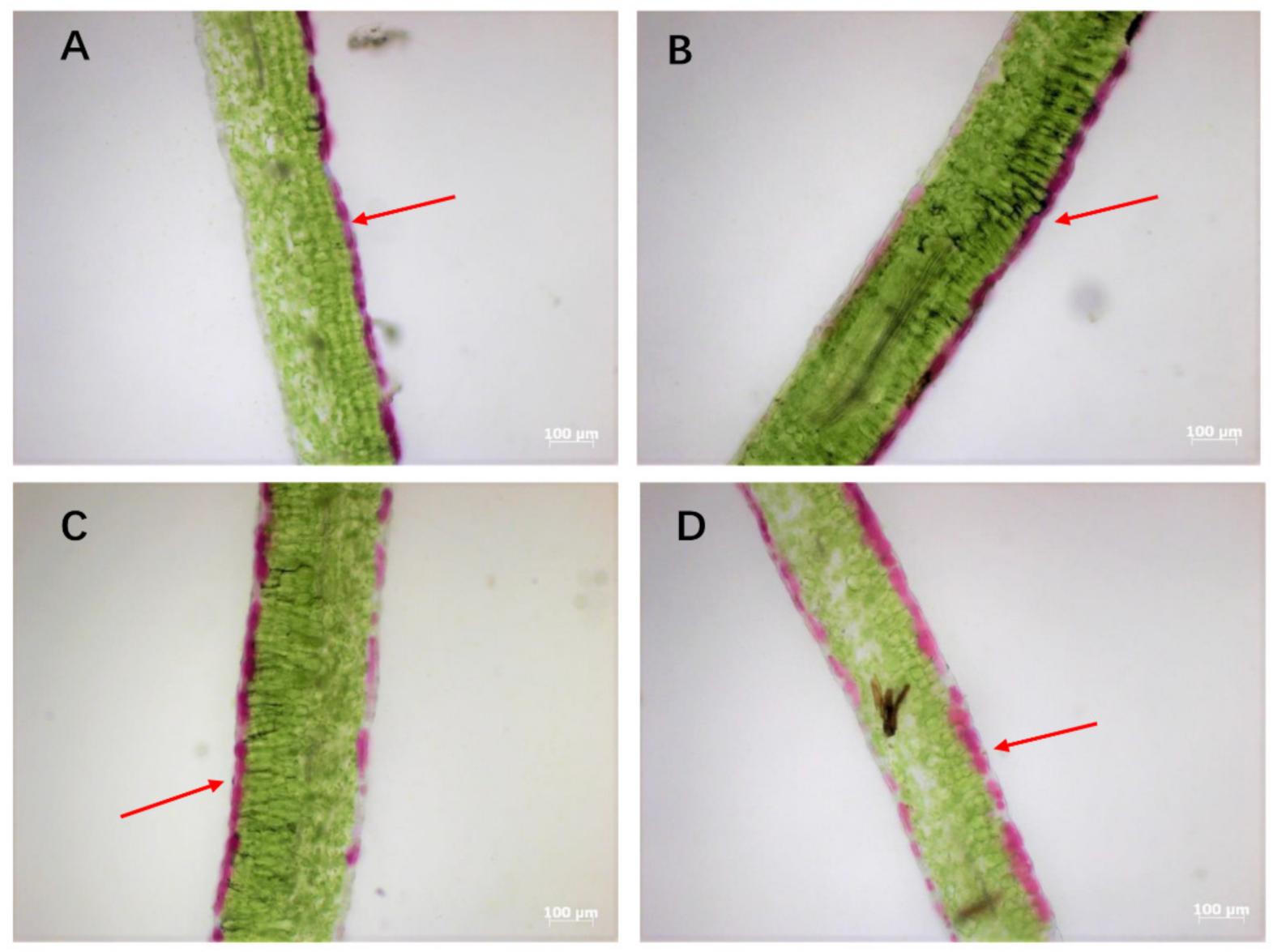 Study of the Relationship between Leaf Color Formation and