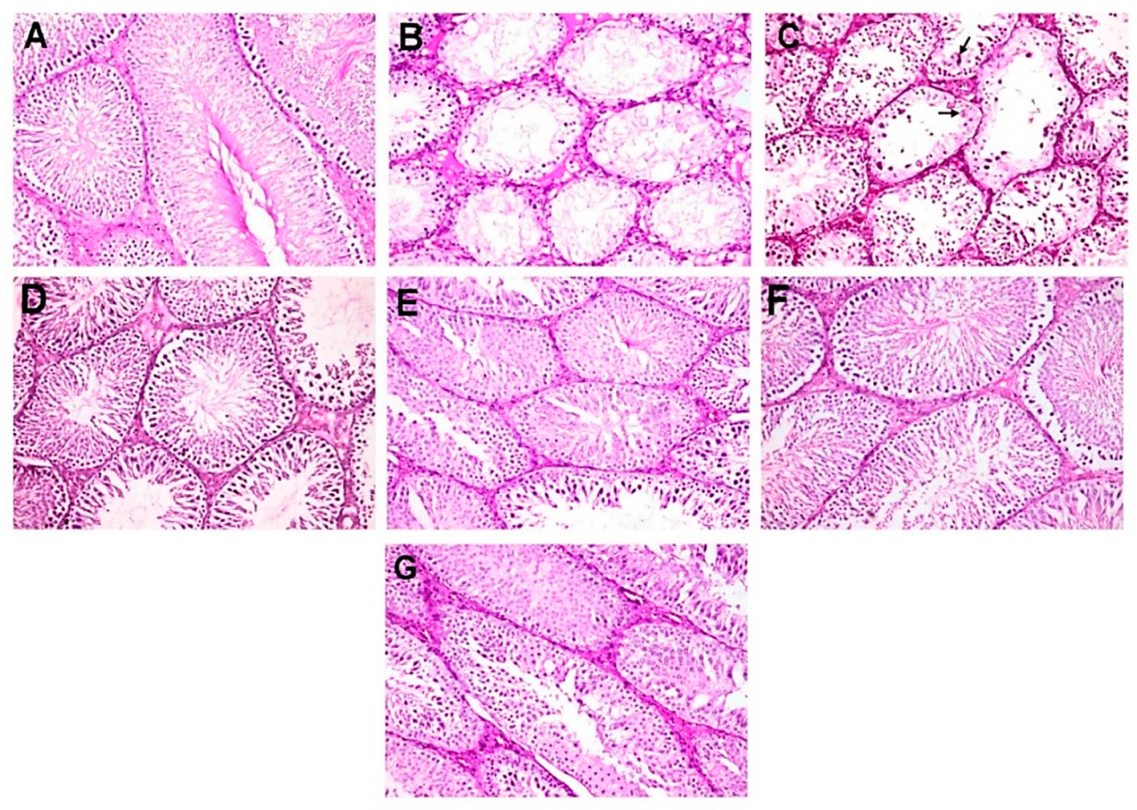 Molecules 25 05255 g003