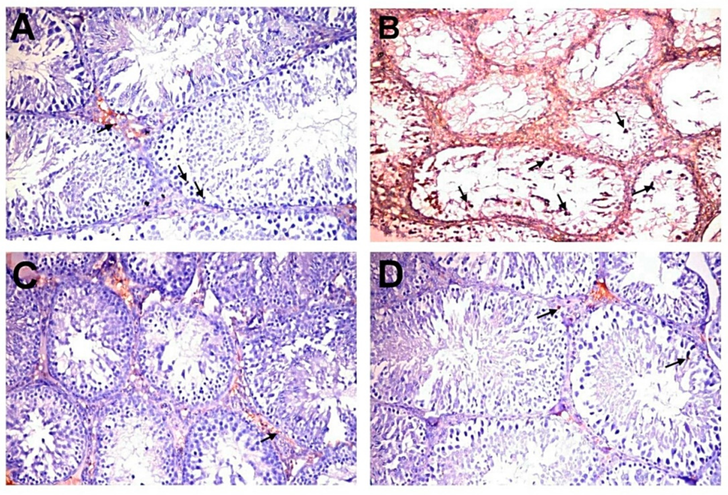 Molecules 25 05255 g005