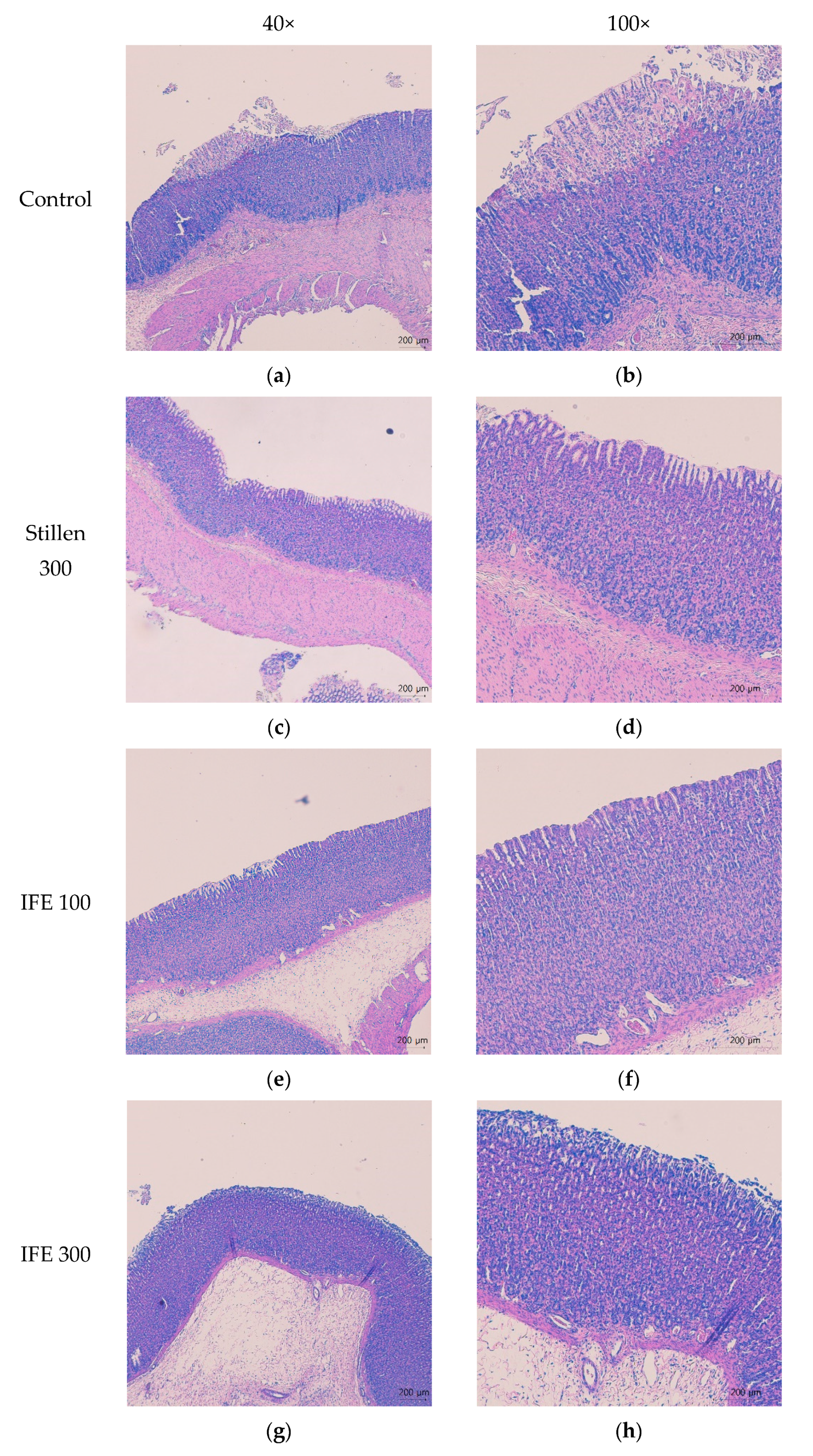 Molecules Free Full Text Gastroprotective Effects Of Inulae Flos On Hcl Ethanol Induced Gastric Ulcers In Rats Html