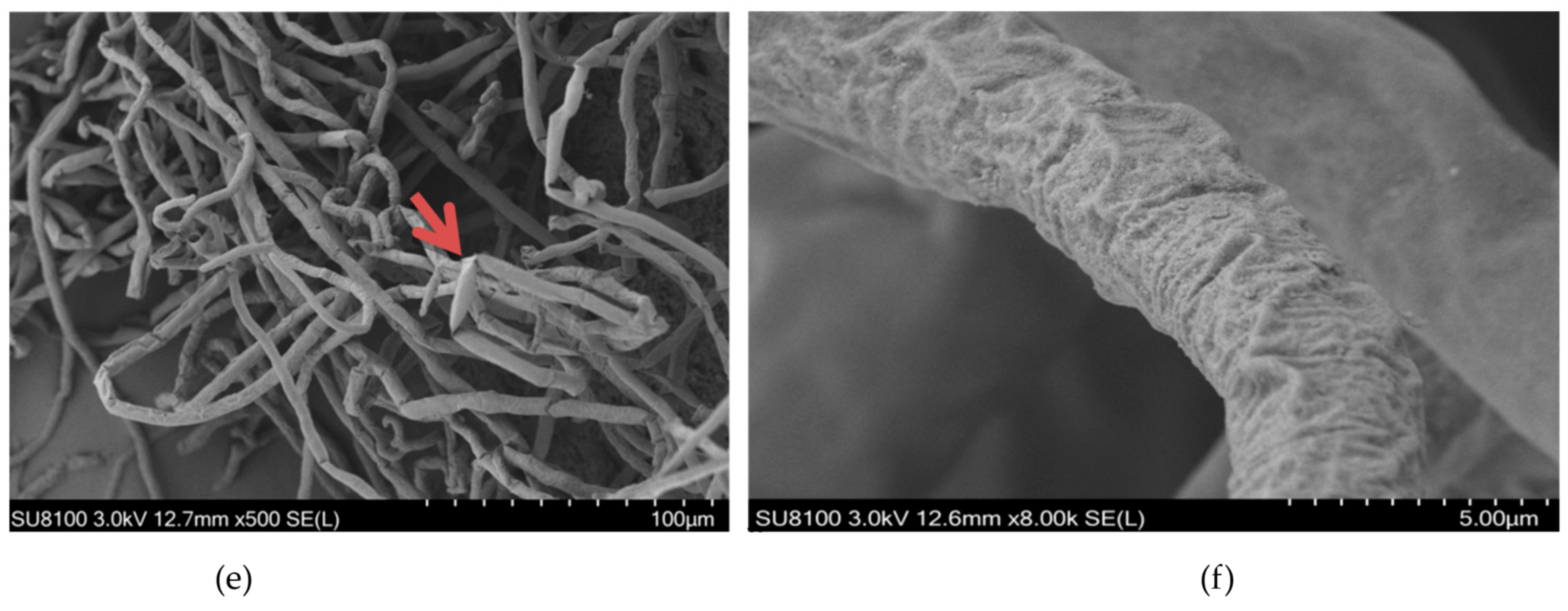 Growth Restriction of Rhizoctonia solani via Breakage of