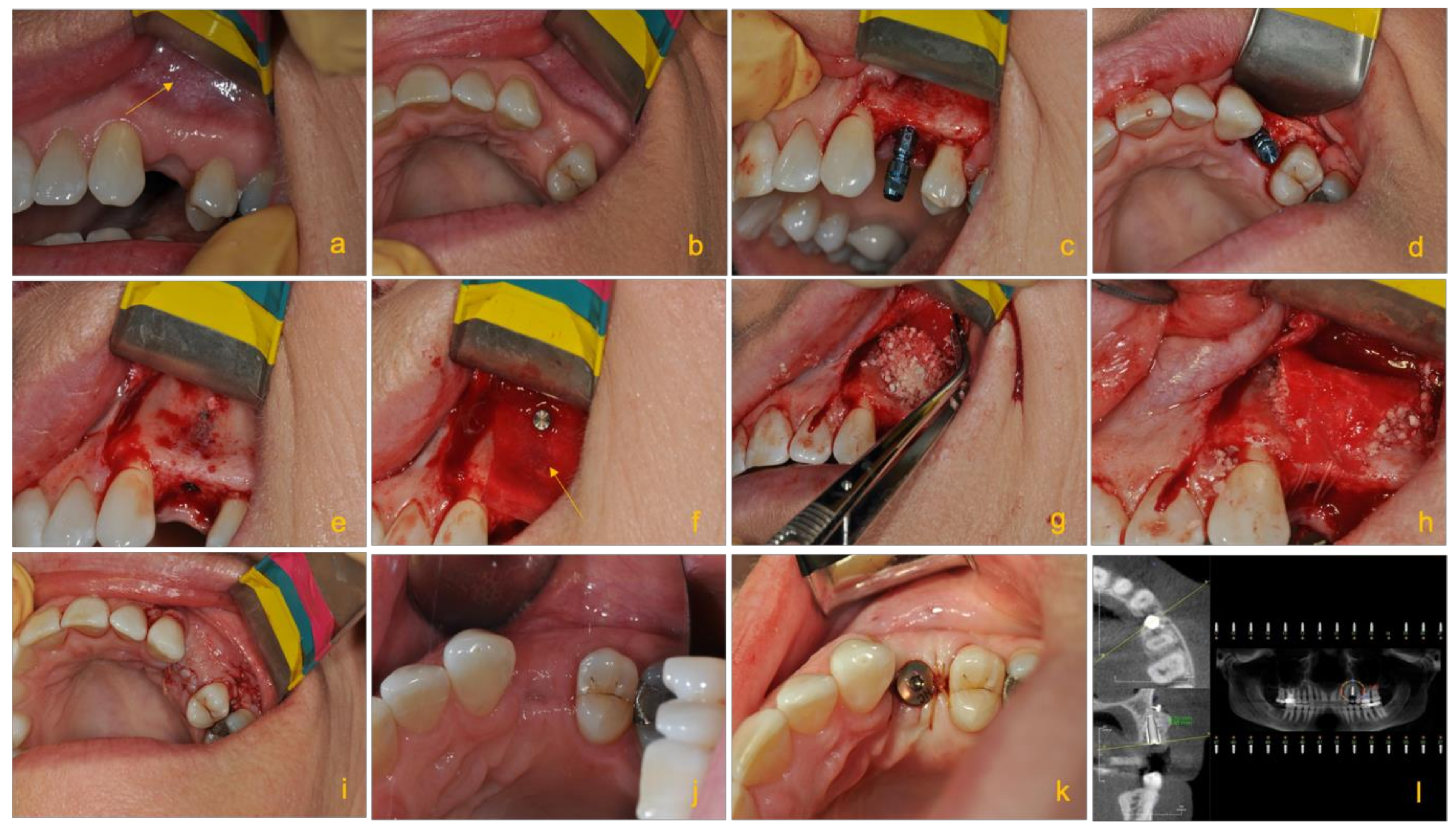 Molecules 26 03007 g003 Molecules 26 03007 g003