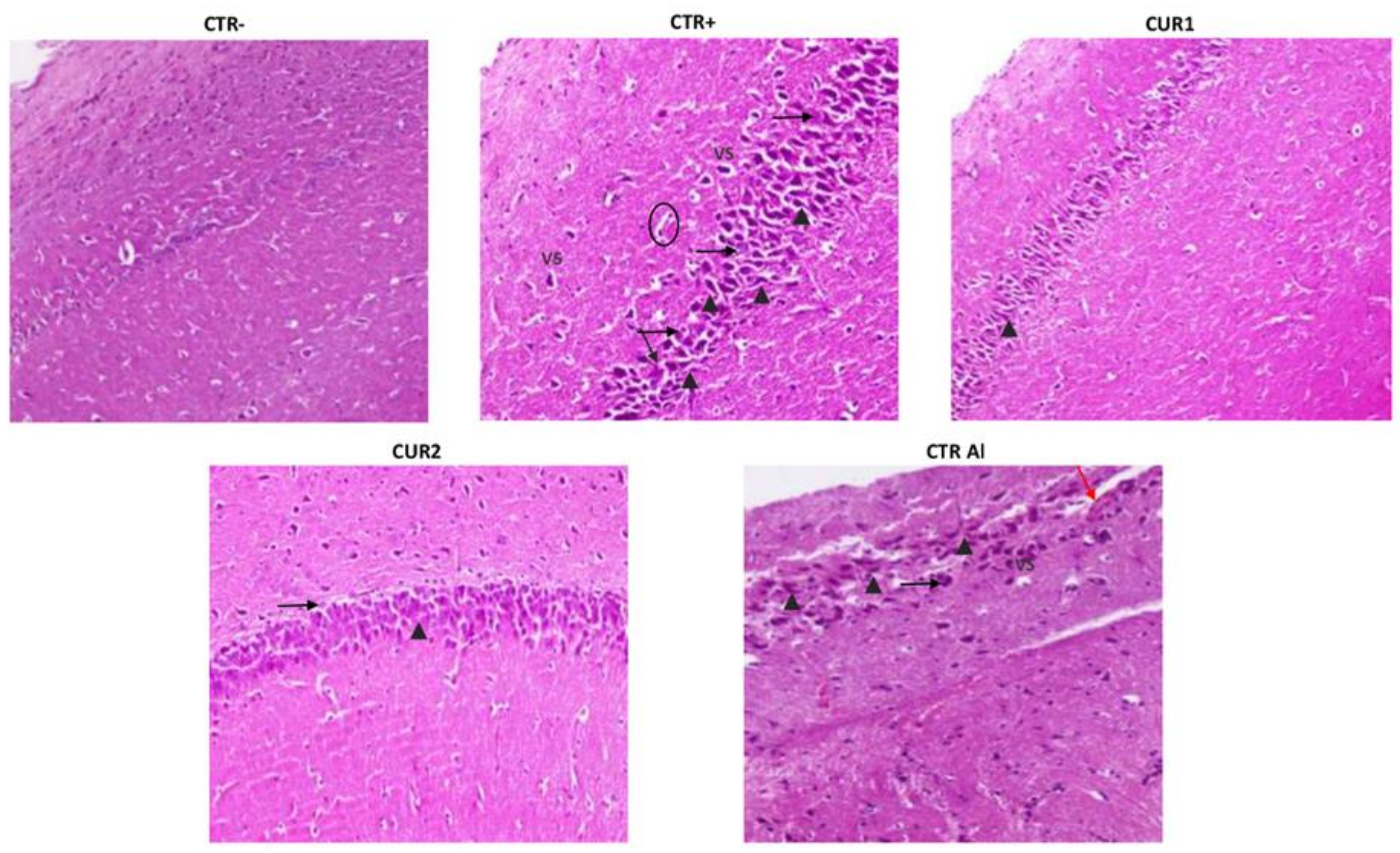 Molecules 26 03011 g006 Molecules 26 03011 g006