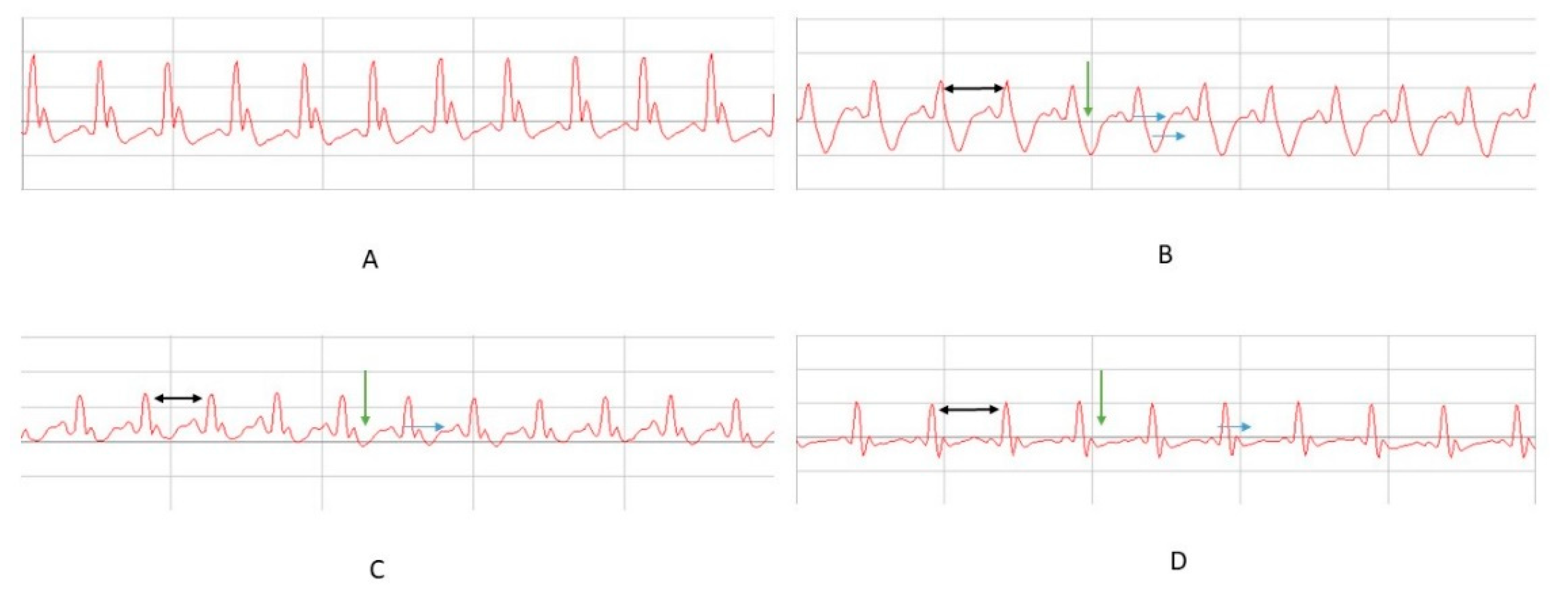 Molecules 26 03221 g004 Molecules 26 03221 g004