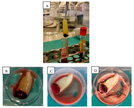 Lyophilised Platelet-Rich Fibrin: Physical and Biological