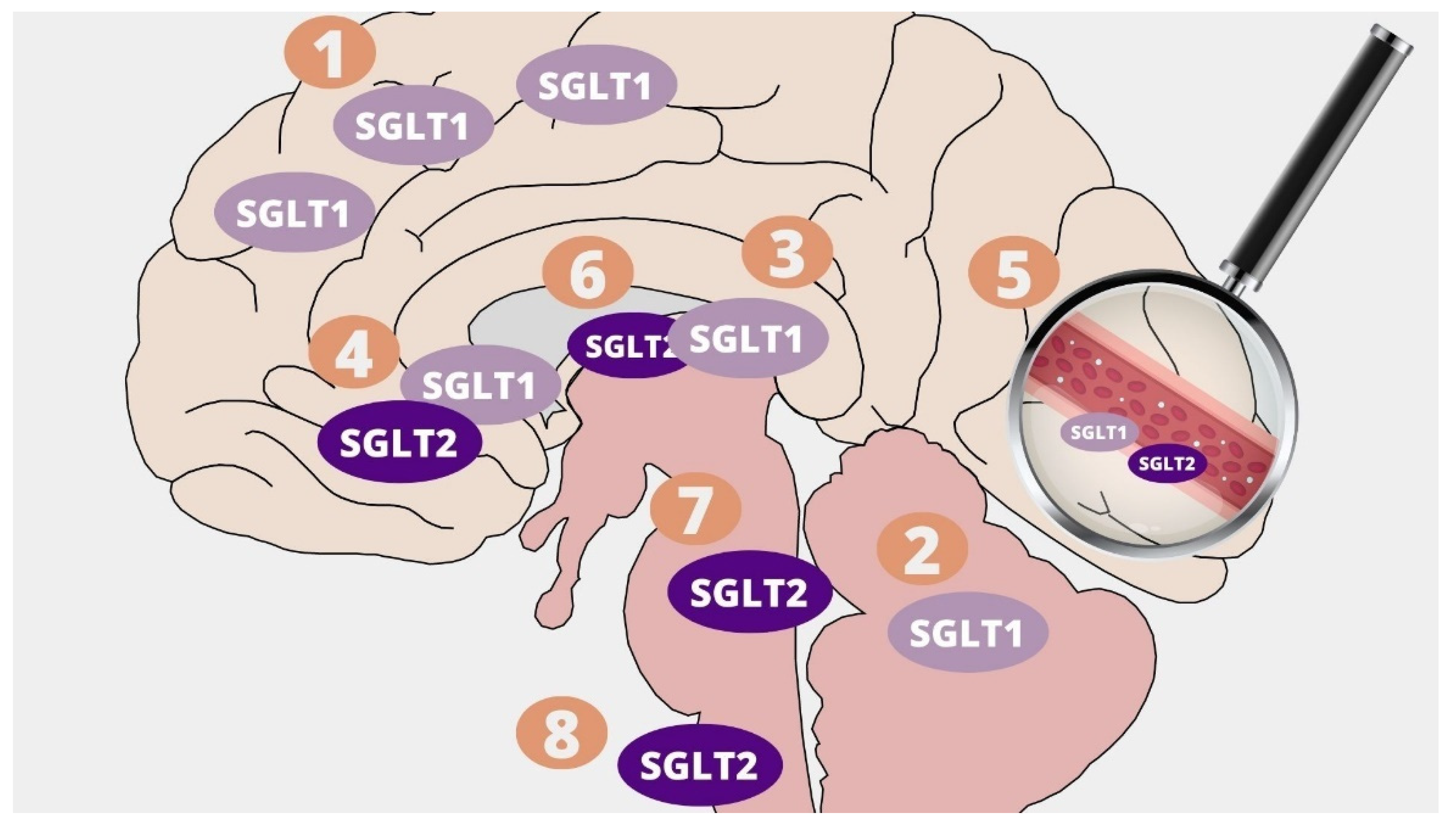 Neuroprotective Effect of SGLT2 Inhibitors