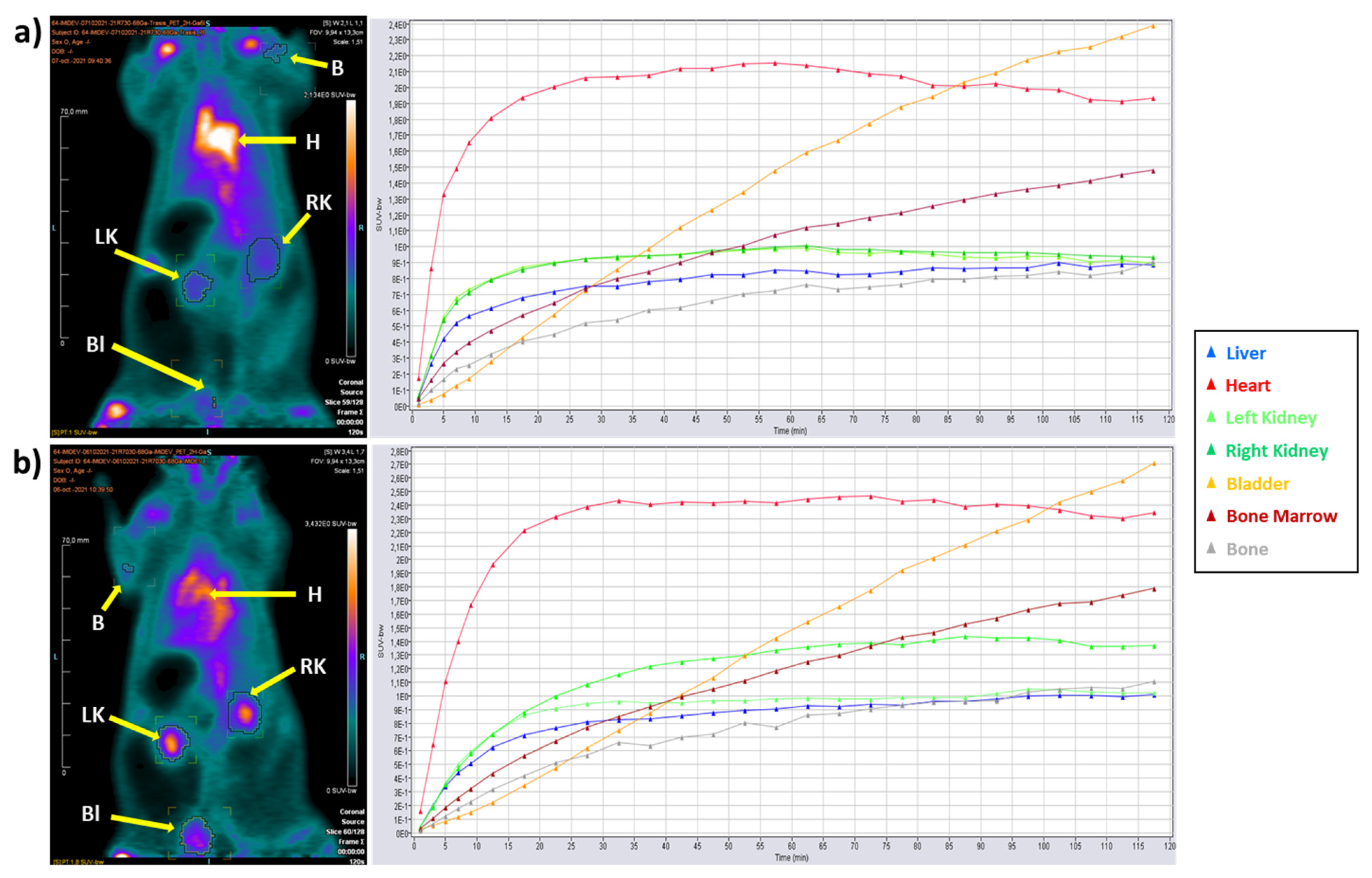 Fully Automated Macro- and Microfluidic Production of [68Ga Fully Automated Macro- and Microfluidic Production of [68Ga