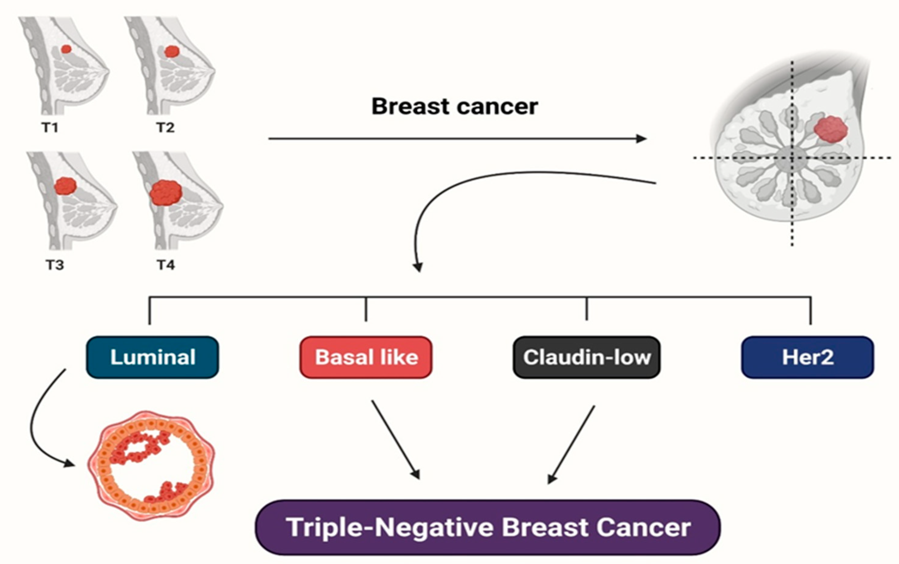 Breast different shapes Ahmed Ali Hassan, MD 