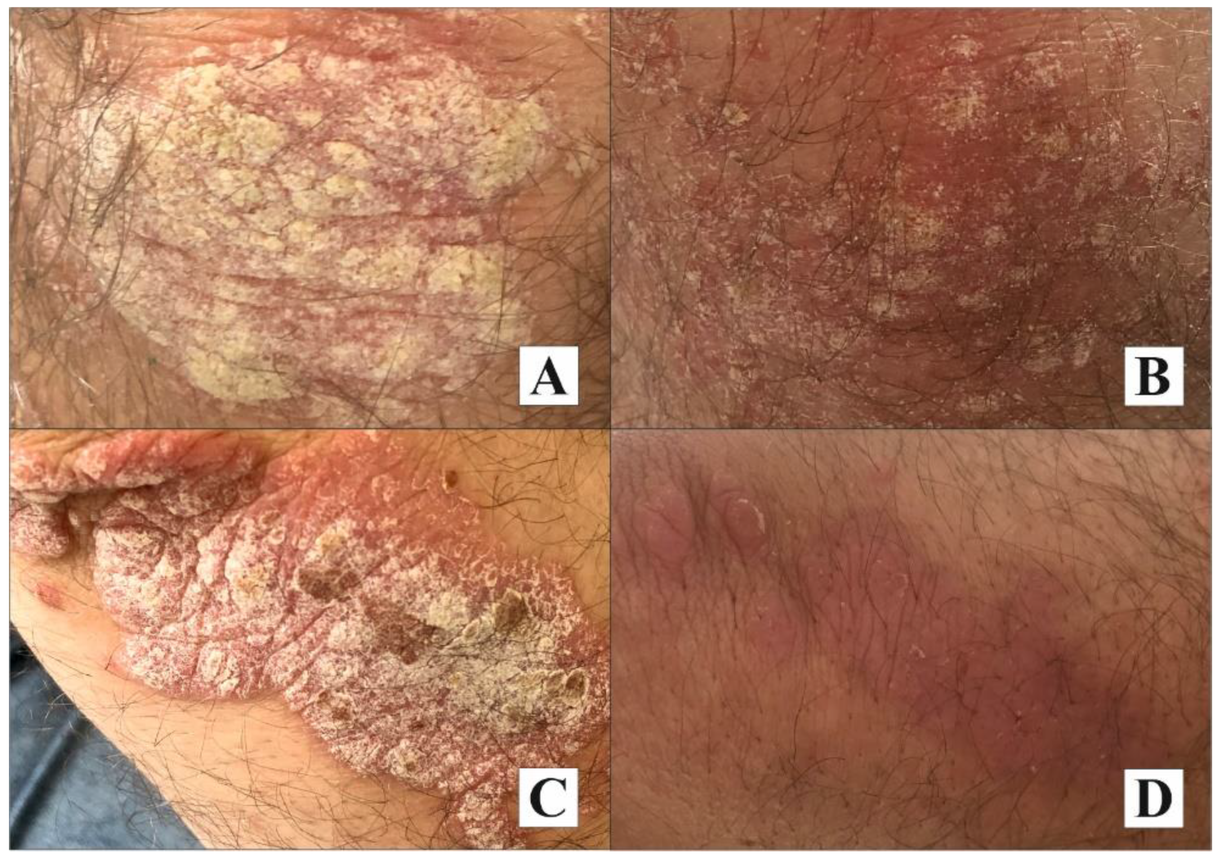 Molecules 27 03471 g004