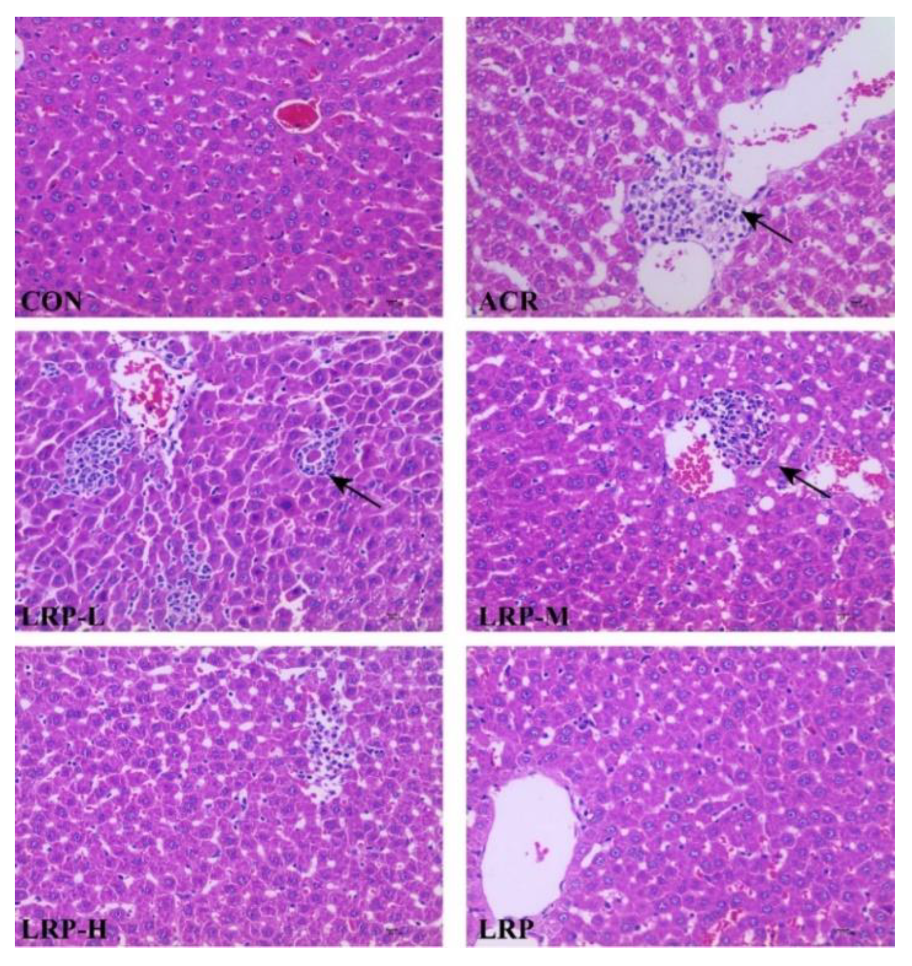 The Protective Effect of Lycium barbarum Betaine and Effervescent Tablet  Against Carbon Tetrachloride-Induced Acute Liver Injury in Rats - Yuqing  Zhai, Huaqiang Tang, Qunhui Zhang, Yanfeng Peng, Linlin Zhao, Benyin Zhang,  Yongjing