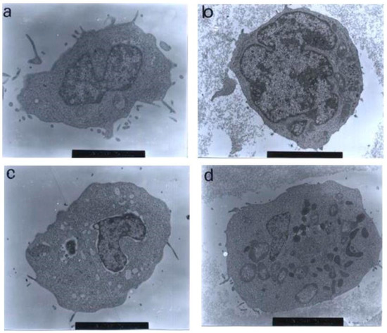 Ultrastructural and Morphological Effects in T-Lymphoblastic