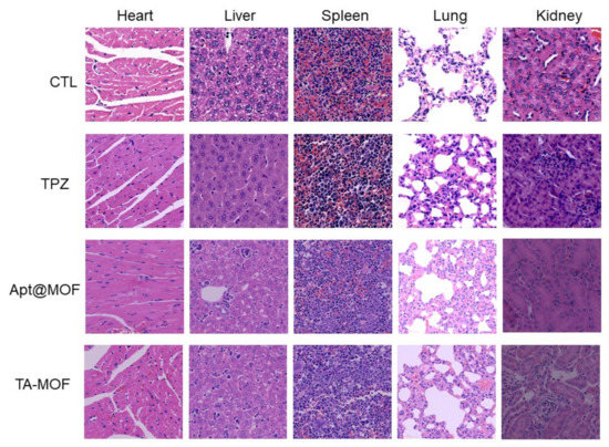 Aptamer-Functionalized Iron-Based Metal–Organic Frameworks