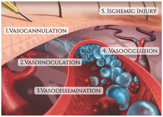 Bridging a Century-Old Problem: The Pathophysiology and