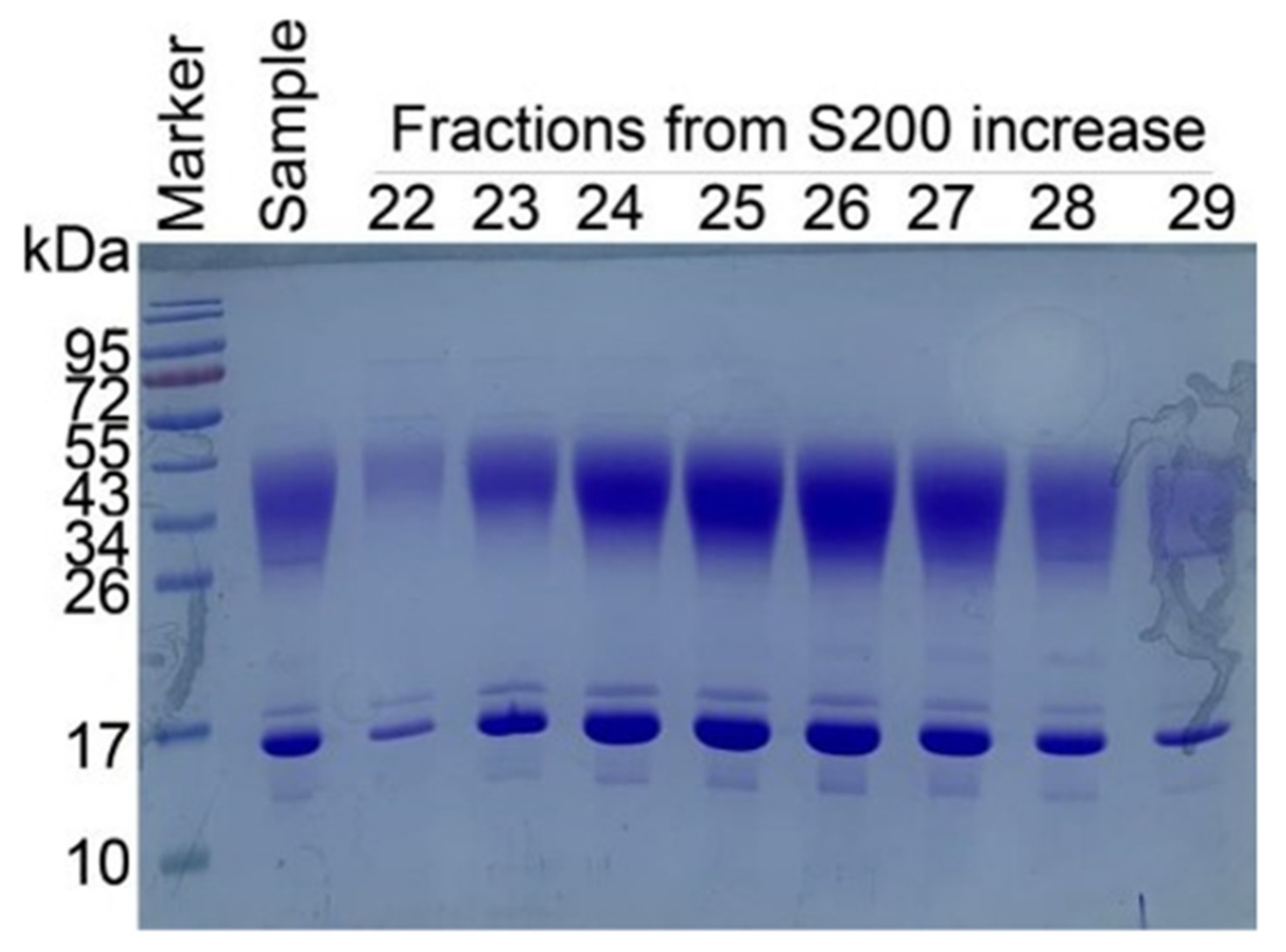 Crystal Structure of Human CD47 in Complex with Engineered Crystal Structure of Human CD47 in Complex with Engineered
