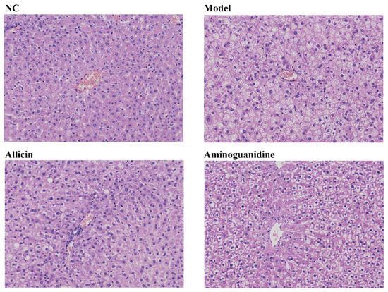 Allicin Alleviates Diabetes Mellitus by Inhibiting the Formation of ...