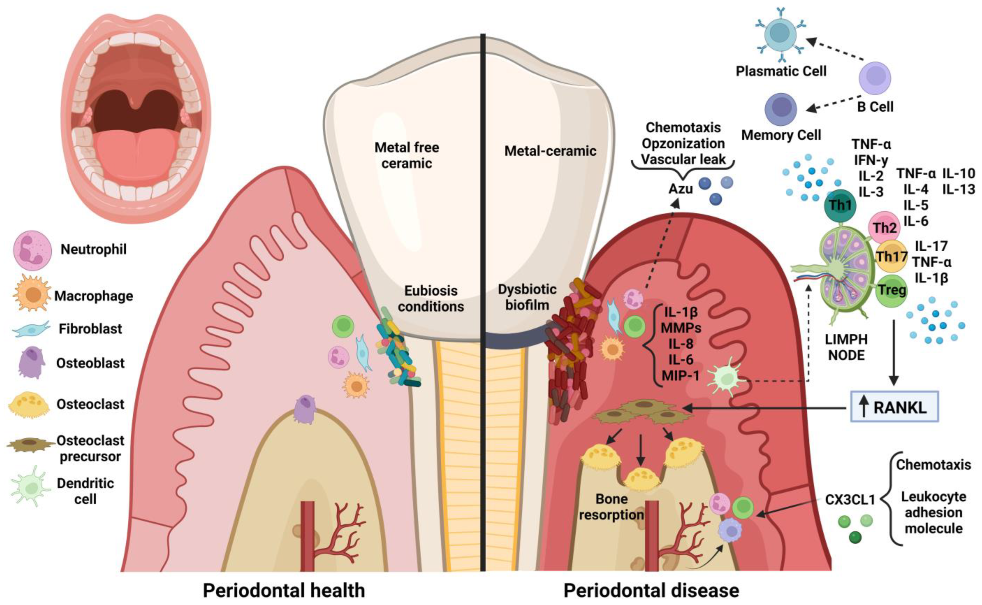 Potential Impact of Prosthetic Biomaterials on the