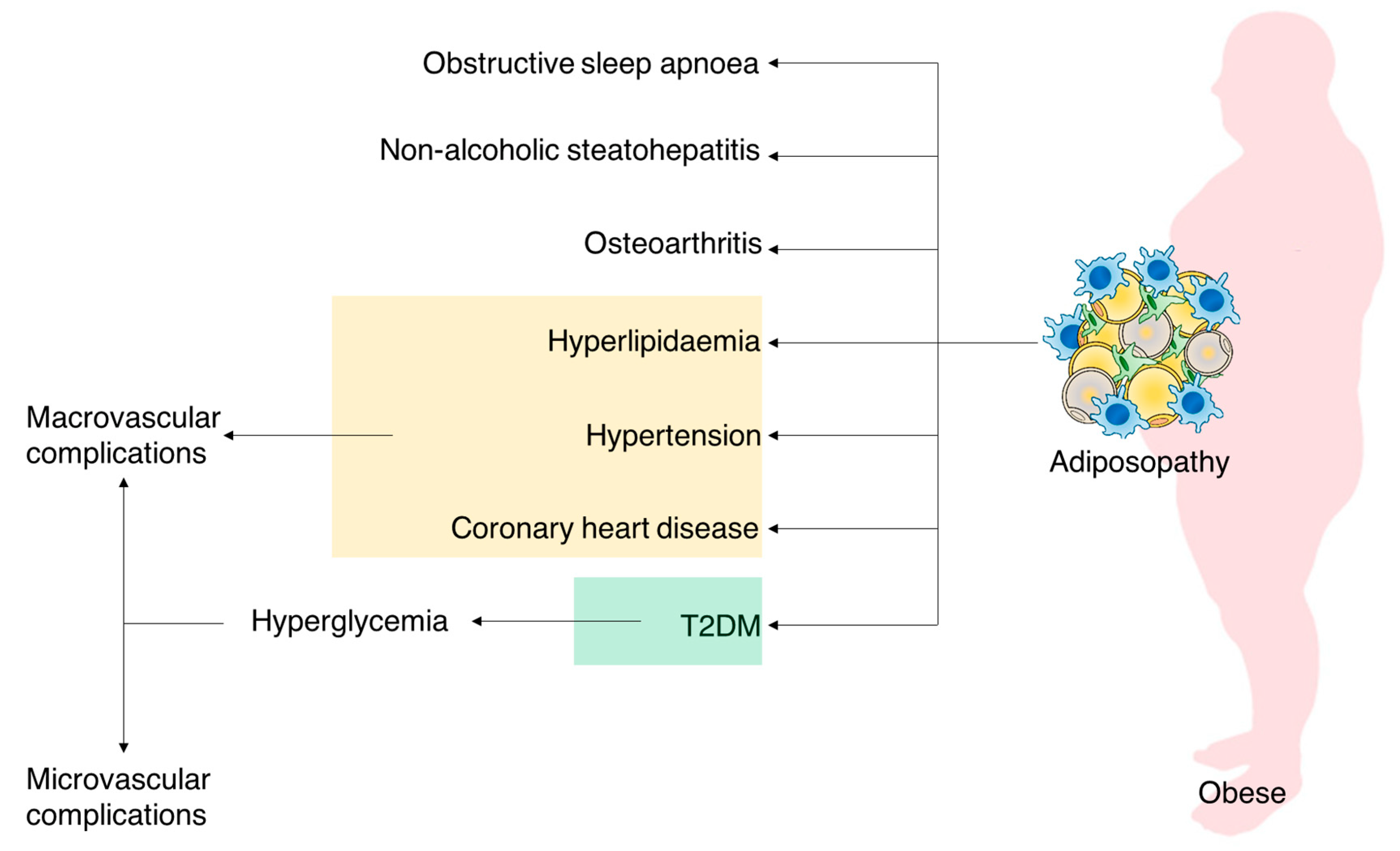 Molecules Free Full-Text Obesity and Type 2 Diabetes Adiposopathy as a Triggering Factor and Therapeutic Options