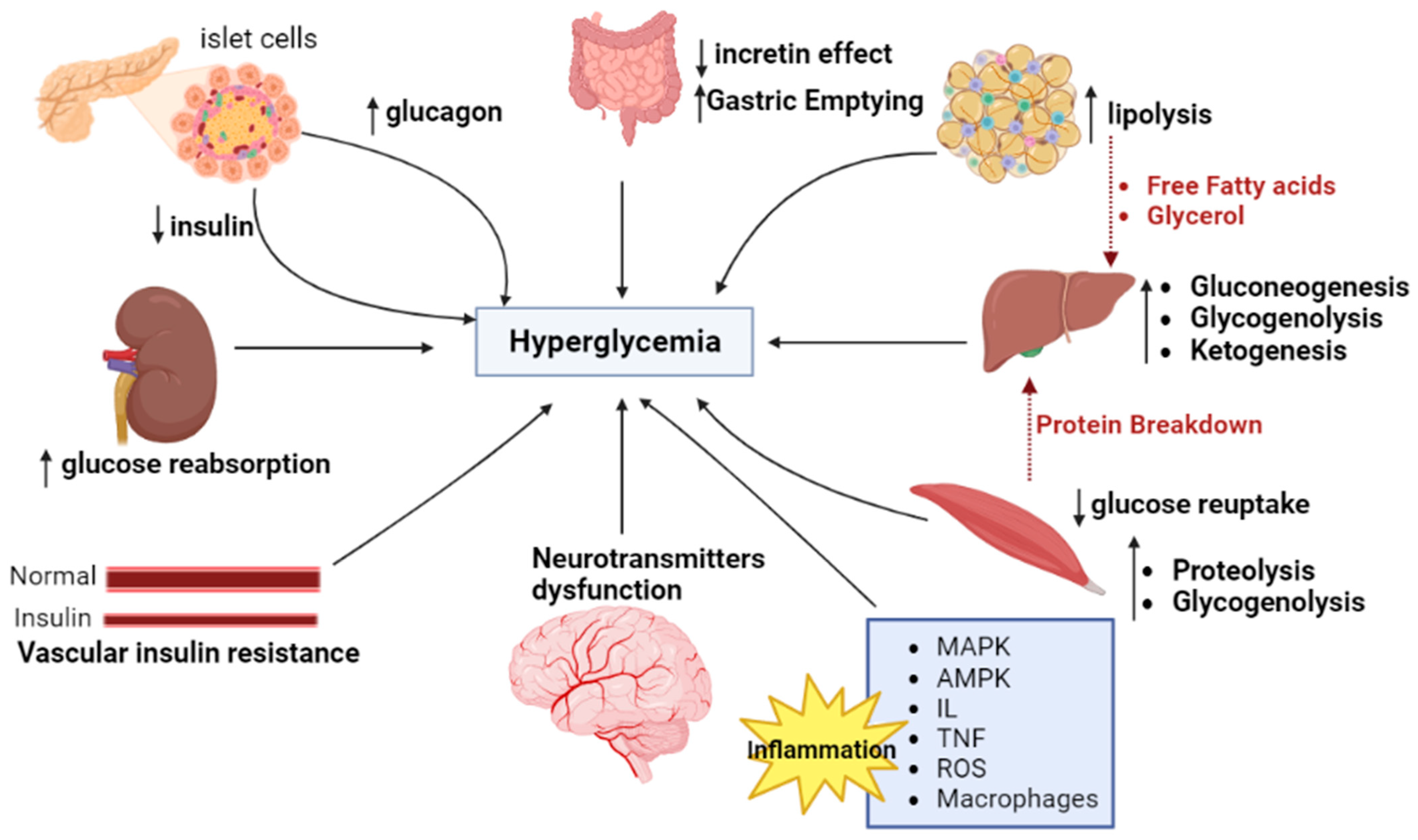 Molecules Free FullText Food Polyphenols and Type II Diabetes Mellitus Pharmacology and