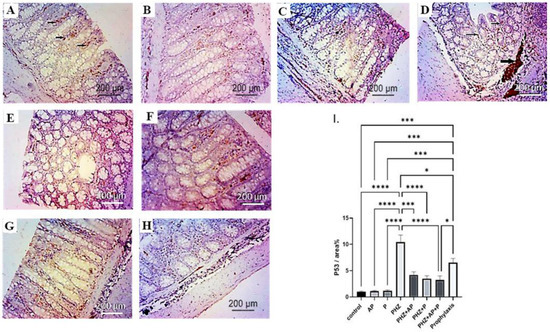 The Antiproliferative Activity of Adiantum pedatum Extract