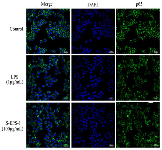 O*******_ Application prospects of ferroptosis in colorectal cancer