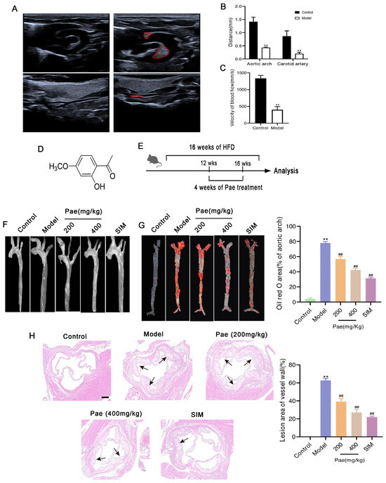 Paeonol Attenuates Atherosclerosis by Inhibiting Vascular Smooth Muscle ...
