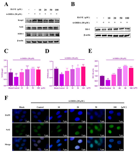 アン ステージ6 ビッグキャブ/ノーマルキャブ用 2WAY ビッグリード