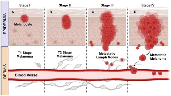 Cutaneous Melanoma: An Overview of Physiological and Therapeutic Aspects and Biotechnological Use of Serine Protease Inhibitors