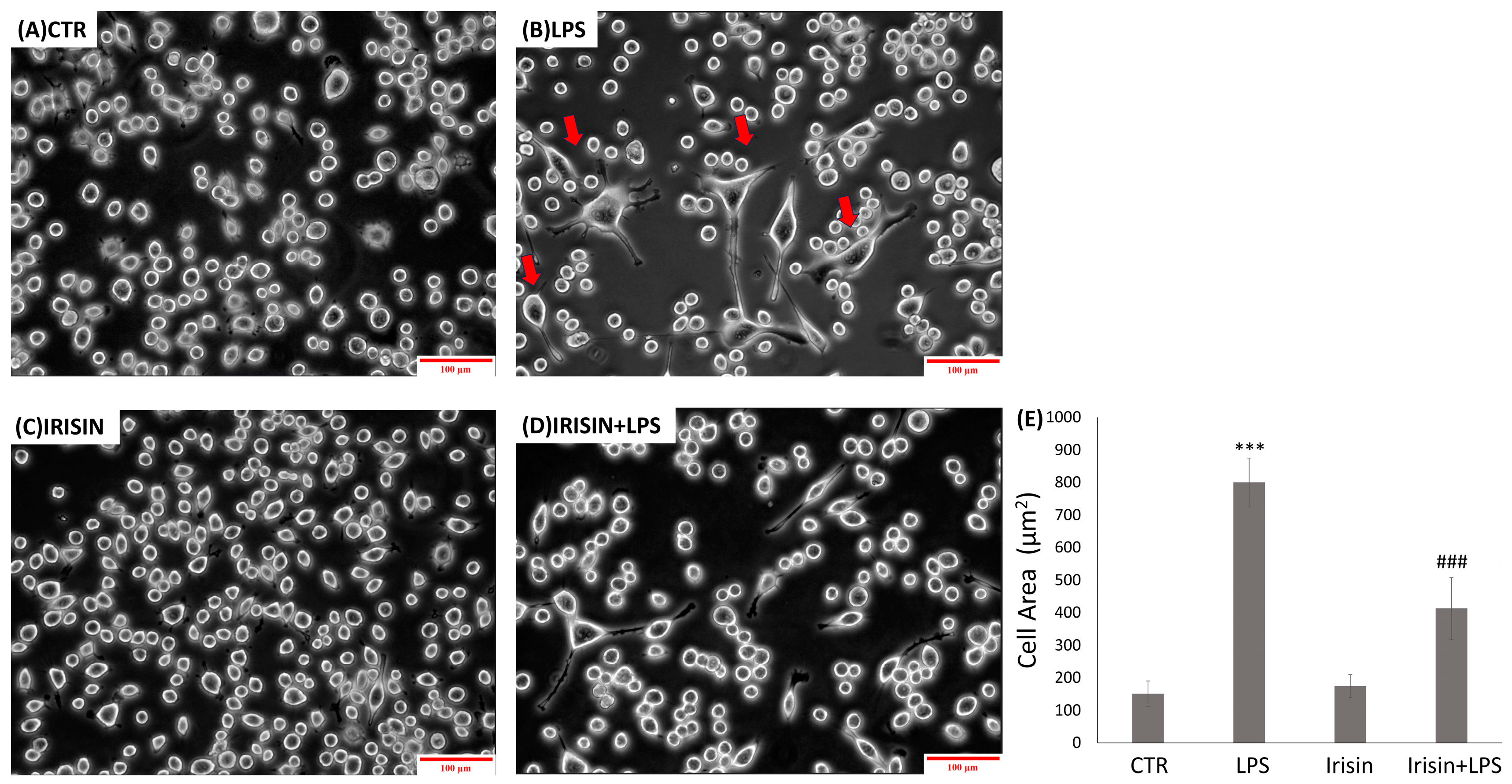 e Irisin Attenuates Neuroinflammation Targeting the NLRP3