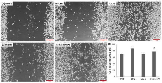 Irisin Attenuates Neuroinflammation Targeting the NLRP3