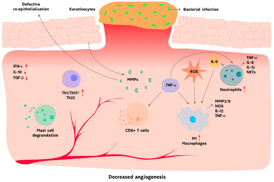 New Perspectives of Hydrogels in Chronic Wound Management