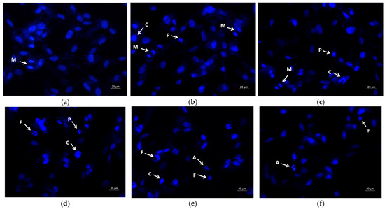 The Effect of Quercetin Loading in Polylactic Acid-Based