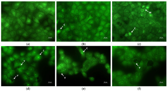 The Effect of Quercetin Loading in Polylactic Acid-Based