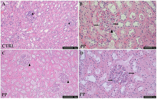 glutathione benefits for kidney is good ckd appropriate patients with chronic disease, and if so, what oral dose and monitoring are recommended? Injectable Glutathione  effect of glutathione on kidney