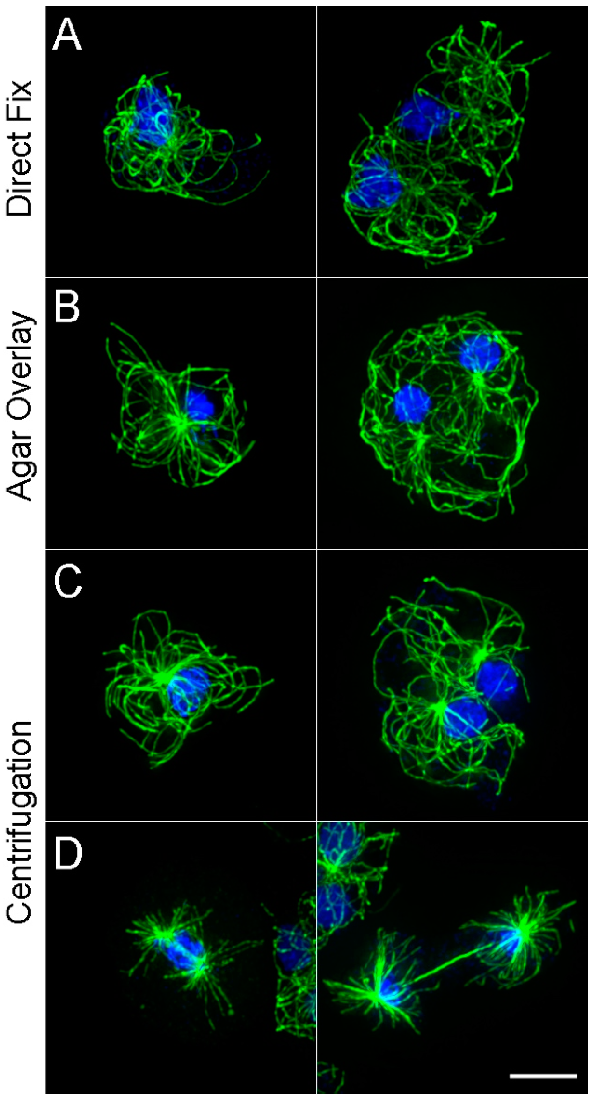 MPs Free FullText Dictyostelium Cell Fixation Two Simple Tricks
