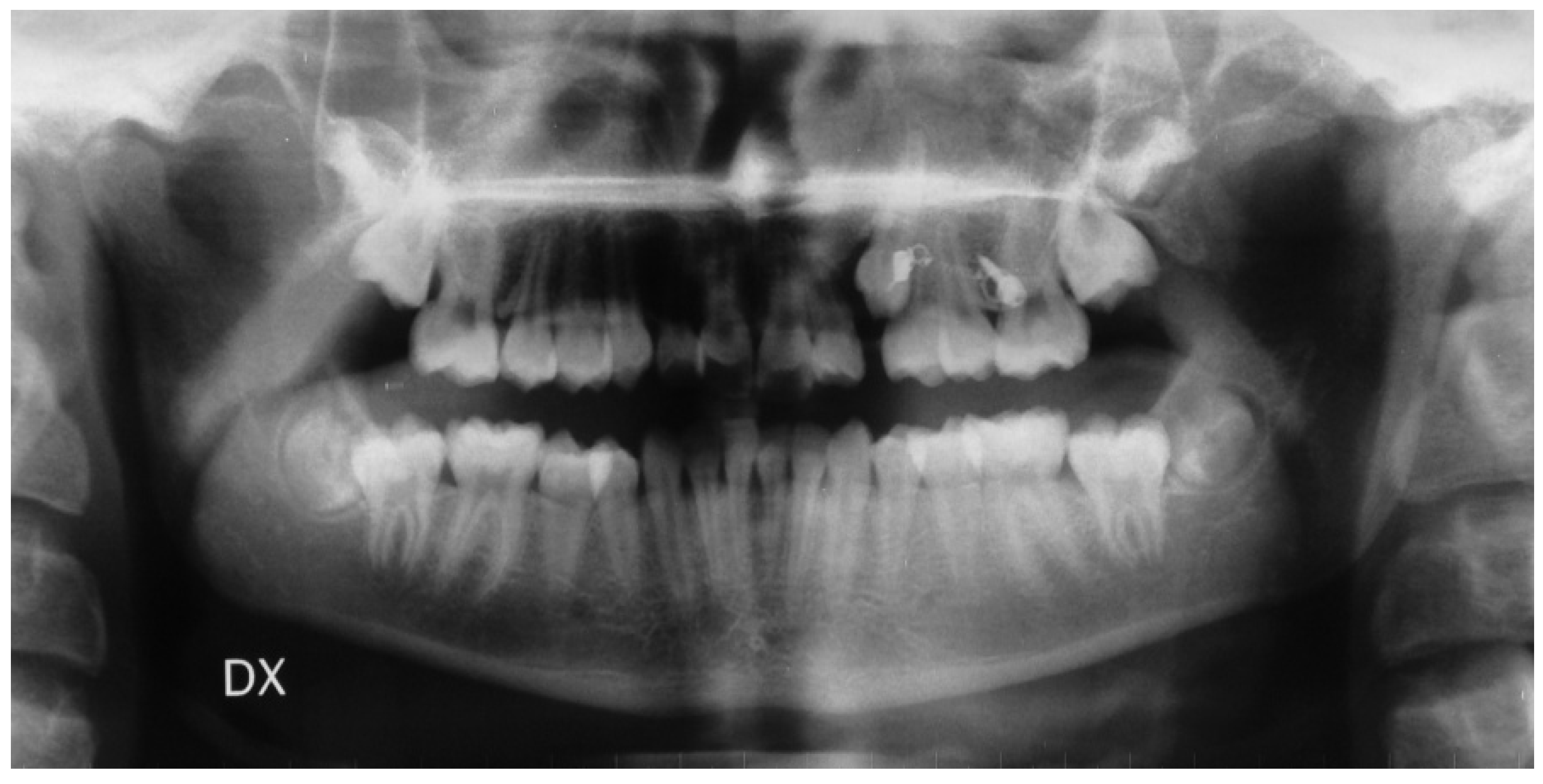 Mps 04 00057 g0a3 550